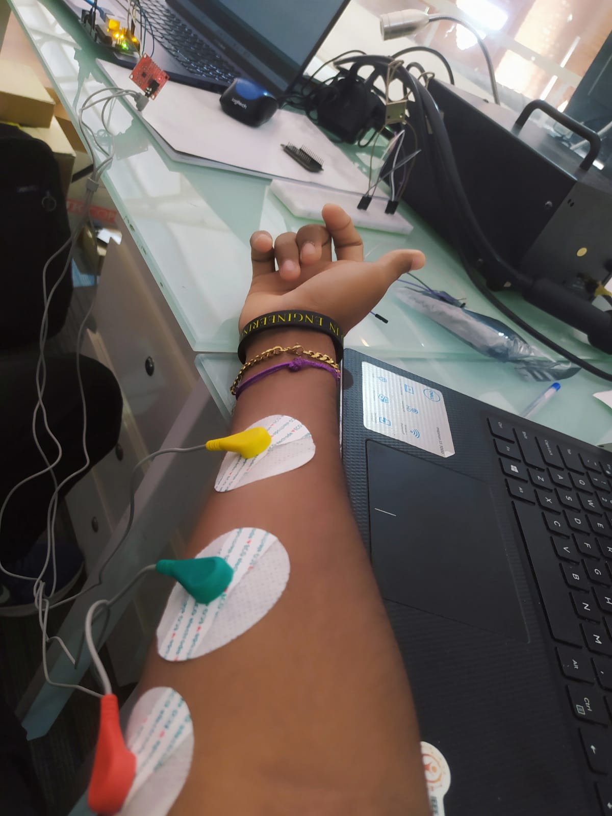 IoT-Based Real-Time Muscle Activity Monitoring System Using EMG Signals